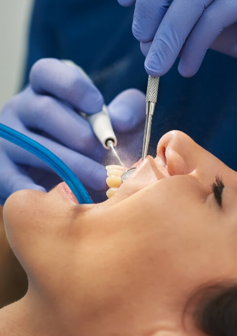 Closeup of dental patient receiving a teeth cleaning