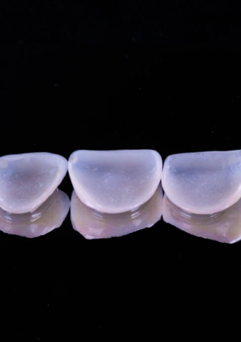 Metal free dental restorations prior to placement