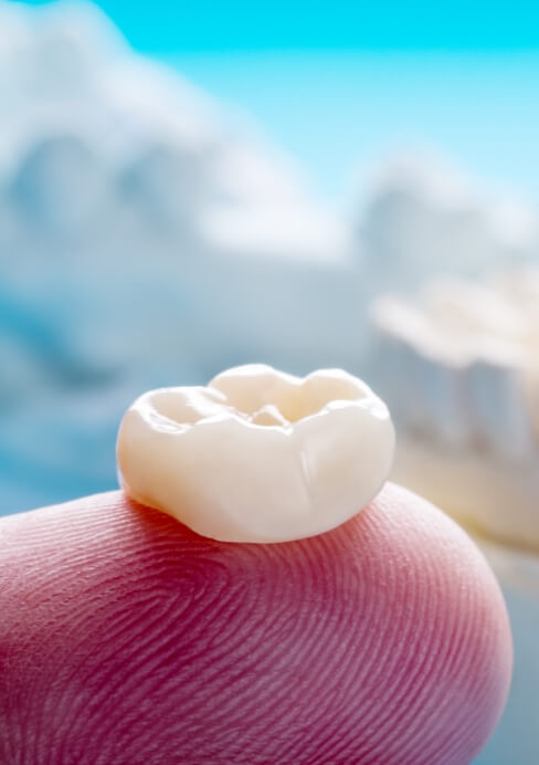 Is a root canal an emergency Is a root canal an emergency
