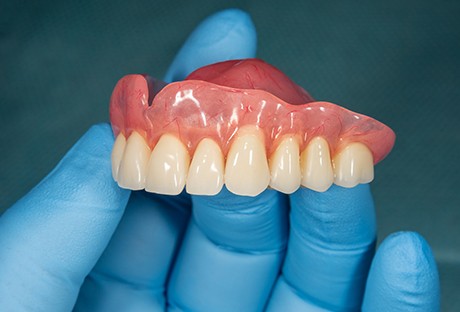 A closeup of an upper denture in a gloved hand