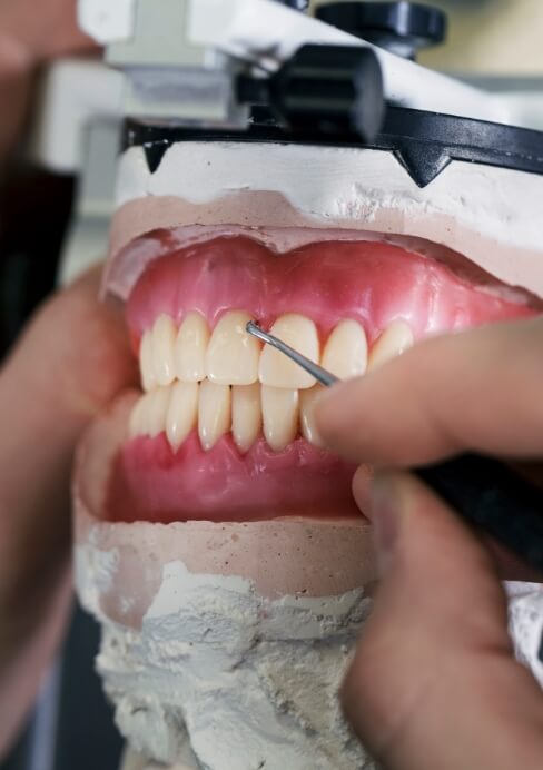 Model smile used to practice gum recontouring