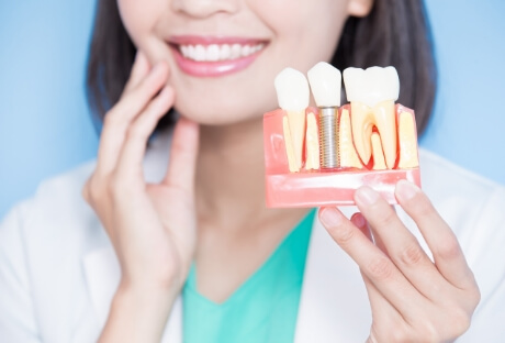 Smiling dentist holding a dental implant model