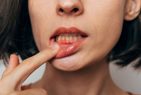 Lady shows inflamed gums