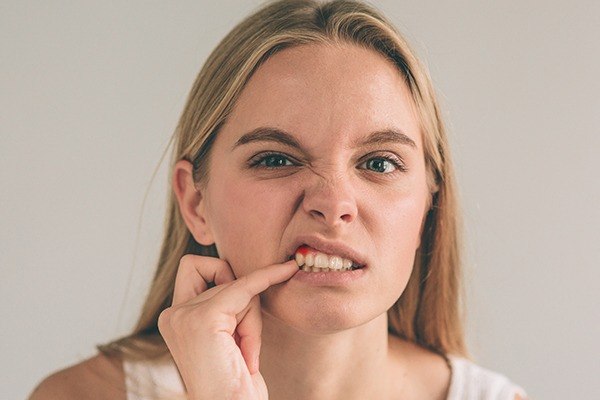 Woman with inflamed gums before gum disease treatment