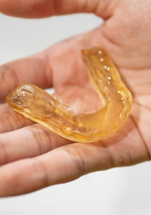 Hand holding a clear nightguard for bruxism