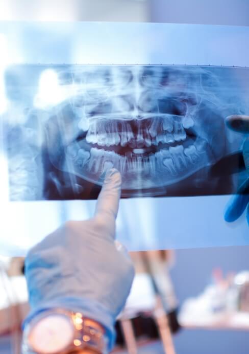 Dentist pointing to panoramic x rays of dental patient's smile